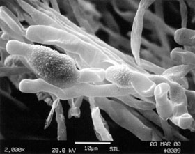 Cladosporium spores under a microscope